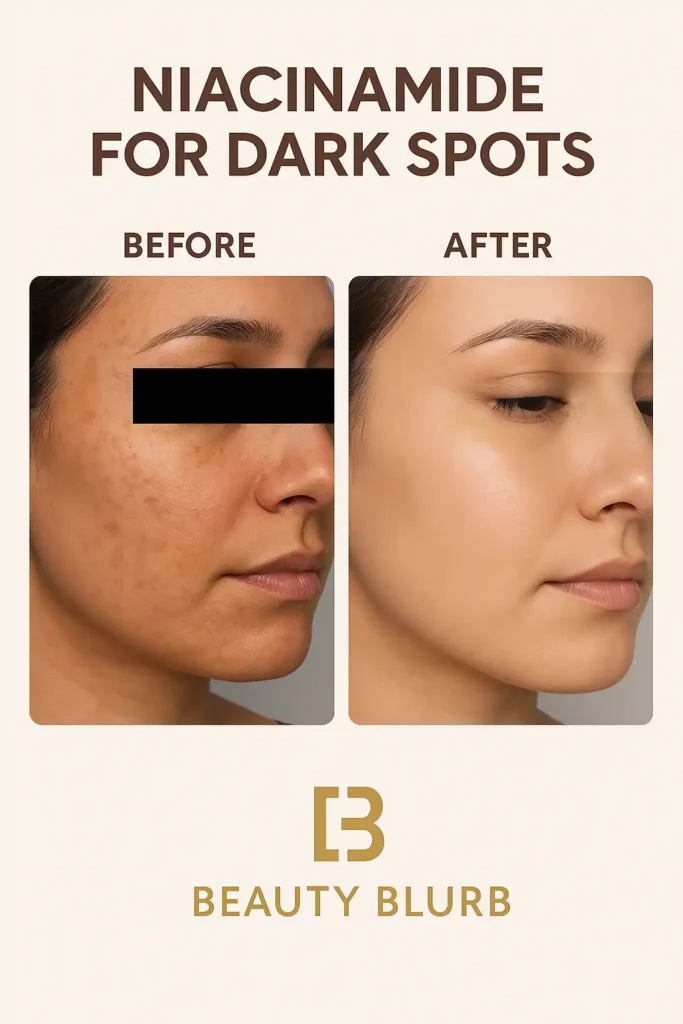Is Niacinamide Good for Dark Spots - The Complete Guide