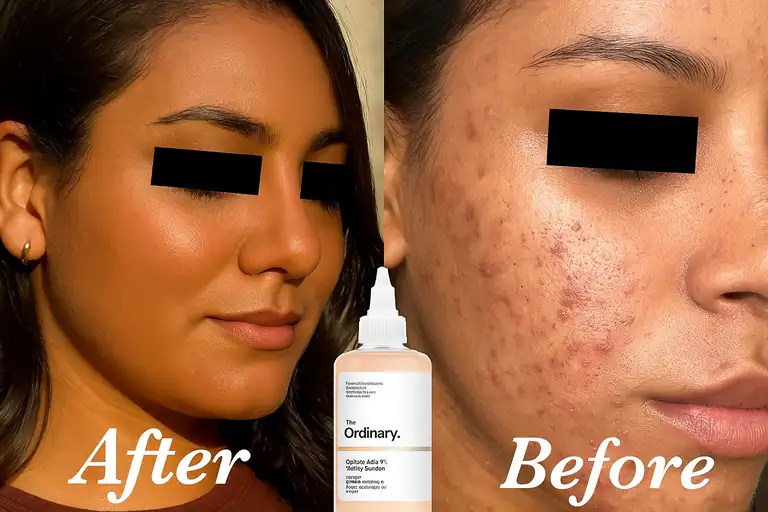 the ordinary glycolic acid 7 toning solution review